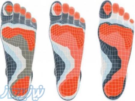تولید کفی و کفش طبی با توجه به اسکن کف پا