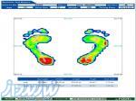 انجام اسکن سه بعدی کف پا ، تولید تراش انواع کفی پا در کرج