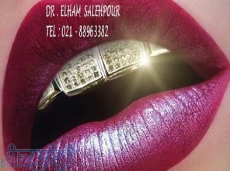 مزایای لمینیت سرامیکی بهترین دندانپزشک زیبایی در مرکز تهران مراحل اصلاح طرح لبخند 