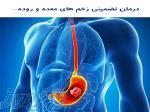 بهبودی و درمان کامل زخم معده به طور تضمینی    