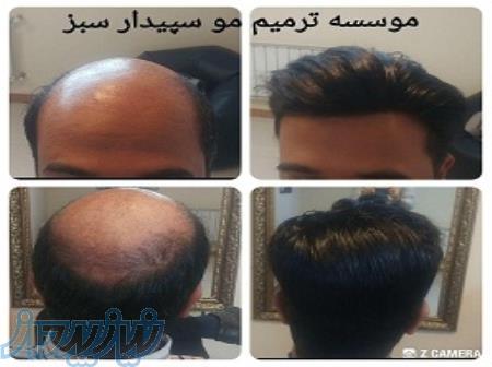 ترمیم مو سپیدار سبز 