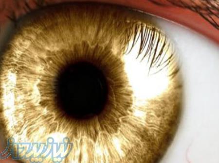 خودهیپنوتیزم و کاربردهای عملی آن 