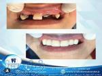 کلینیک دندانپزشکی لبخند،جراحی ایمپلنت پیشرفته،درمان ریشه،ترمیم دندان و