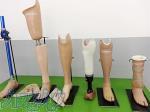 ساخت پای مصنوعی و پروتز های اندام 