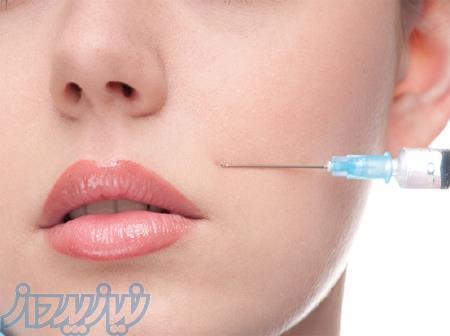 تزریق بوتاکس ژل و فیلر تزریق چربی در مطب توسط پزشک 