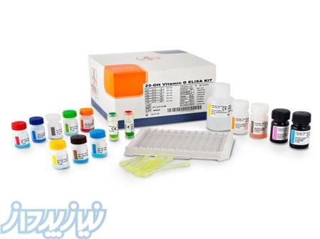 کیت تیرویید   خرید کیت تیرویید TSH   قیمت کیت تیرویید 