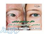 دکتر دواچی متخصص و جراح افتادگی پلک 