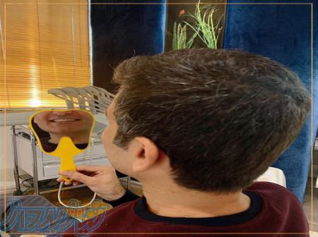 دندانپزشکی زیبایی در شمال تهران 