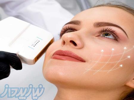 هایفوتراپی معجزه جوانی و لیفت صورت 