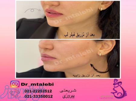 بهترین کلینیک لیزر پوست درشریعتی