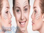 فرم دهی بینی بدون جراحی در تهران