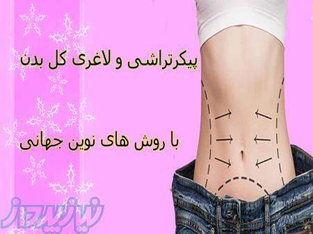 از بین بردن چربی شکم و پهلو بصورت تخصصی در تهران