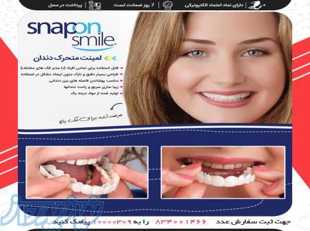 لمینت متحرک دندان - Snap On Smile 