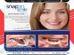 لمینت متحرک دندان - Snap On Smile 