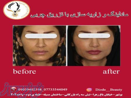 کلینیک زیبایی و لیزر موهای زائد دایود 
