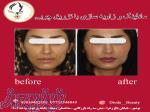 کلینیک زیبایی و لیزر موهای زائد دایود 