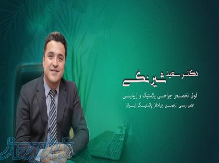 جراحی زیبایی بینی در تهران دکتر سعید شیرنگی 