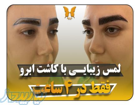 مرکز زیبایی آیتک   کاشت ابرو   کاشت مو طبیعی  خدمات زیبایی 