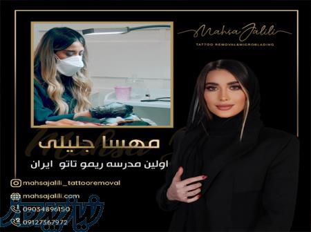 ریموو تاتو بدون درد باپیشرفته ترین روشهای پاک کردن تاتو در جهان 