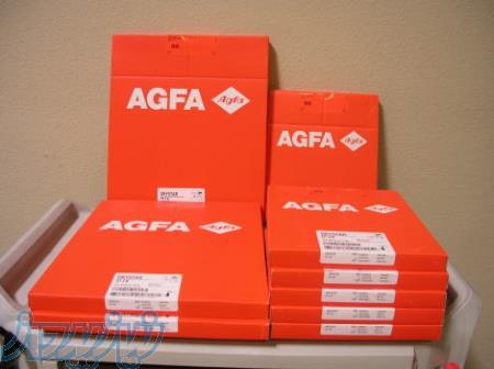 فیلم رادیولوژی با قیمت مناسب 