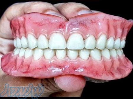 ساخت دندان مصنوعی 