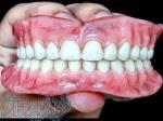 ساخت دندان مصنوعی 