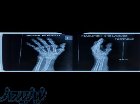 عکس رادیولوژی در منزل 