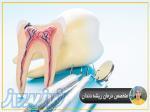 متخصص درمان ریشه دندان 