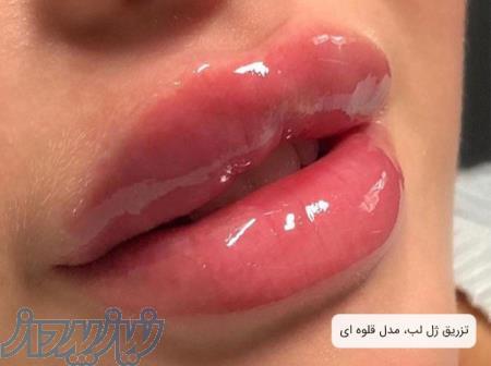 کلینیک زیبایی آمیتیس یزد ارائه انواع خدمات تزریق ژل، بوتاکس، مزوتراپی و     