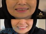 دندانسازی و دندانپزشکی 