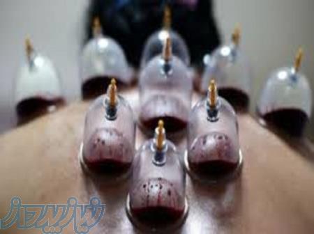 آموزش صفر تا صد و تضمینی حجامت