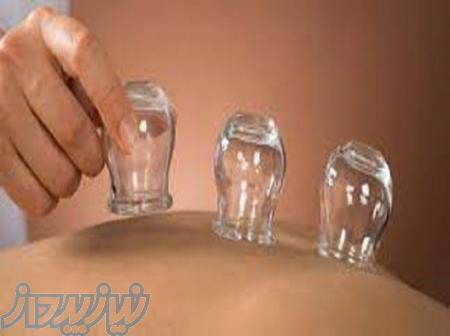 آموزش جامع و کامل بادکش درمانی