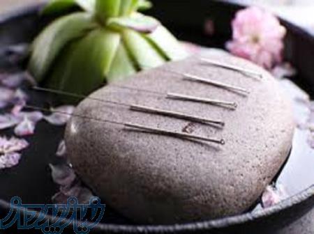 آموزش طب سوزنی به صورت تخصصی و جامع و کامل