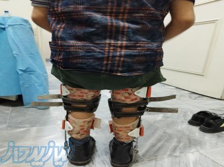 اسکن کف پا ، کفی وکفش طبی 