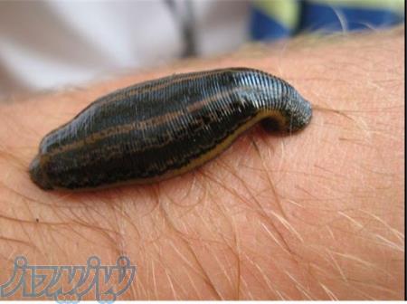 فروش زالو استریل کیرلیی دار 