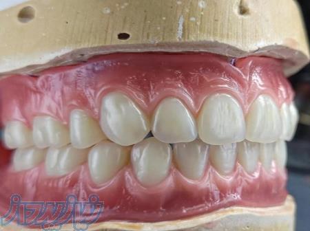 ساخت دندان مصنوعی رایگان 