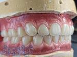 ساخت دندان مصنوعی رایگان 