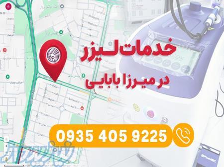 خدمات لیزر در میرزا بابایی   کلینیک لیزر ارغوان