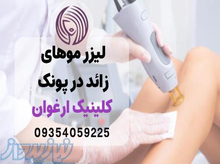 لیزر موهای زائد در پونک   مرکز لیزر ارغوان