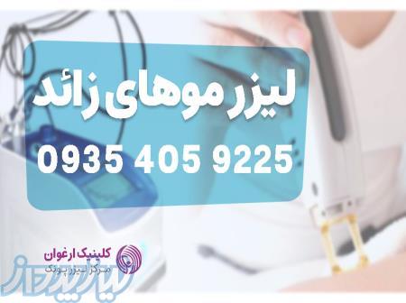 لیزر تخصصی موهای زائد زیر نظر پزشک   کلینیک ارغوان