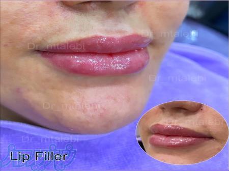 دکترمهشیدطالبی پزشک پوست وزیبایی