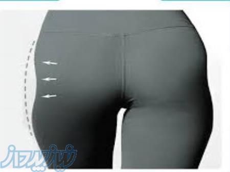 مرکزتزریق فیلربادی درتهران-دکترمهشیدطالبی