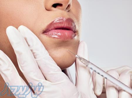 تزریق ژل لب طبیعی 