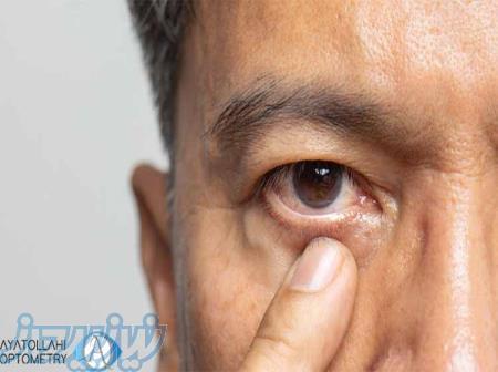 تجهیزات کم‌ بینایی؛ زندگی روشن‌تر با کمک تخصص آیت‌اللهی اپتومتری 