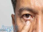تجهیزات کم‌ بینایی؛ زندگی روشن‌تر با کمک تخصص آیت‌اللهی اپتومتری 