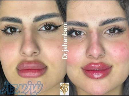 کلینیک زیبایی وایتال فورس 