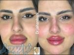 کلینیک زیبایی وایتال فورس 