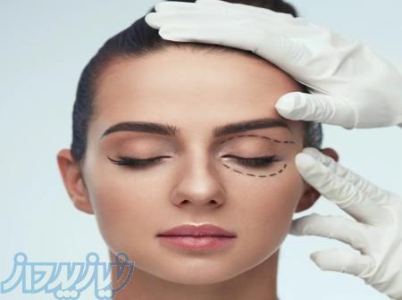 جراحی پلک (بلفاروپلاستی) توسط پزشک جراح مجرب 