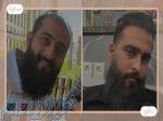 کاشت مو و ابرو با پرداخت 8 تومن و قسطی 