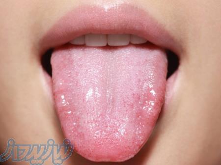 مرکز‌مشاوره‌رایگان‌طب‌سنتی‌فقط‌با‌عکس‌زبان‌شما   